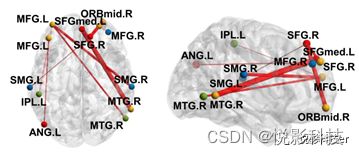 FNIRS功能近紅外數(shù)據(jù)處理服務